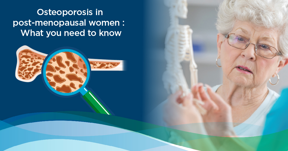 osteoporosis and postmenopausal women